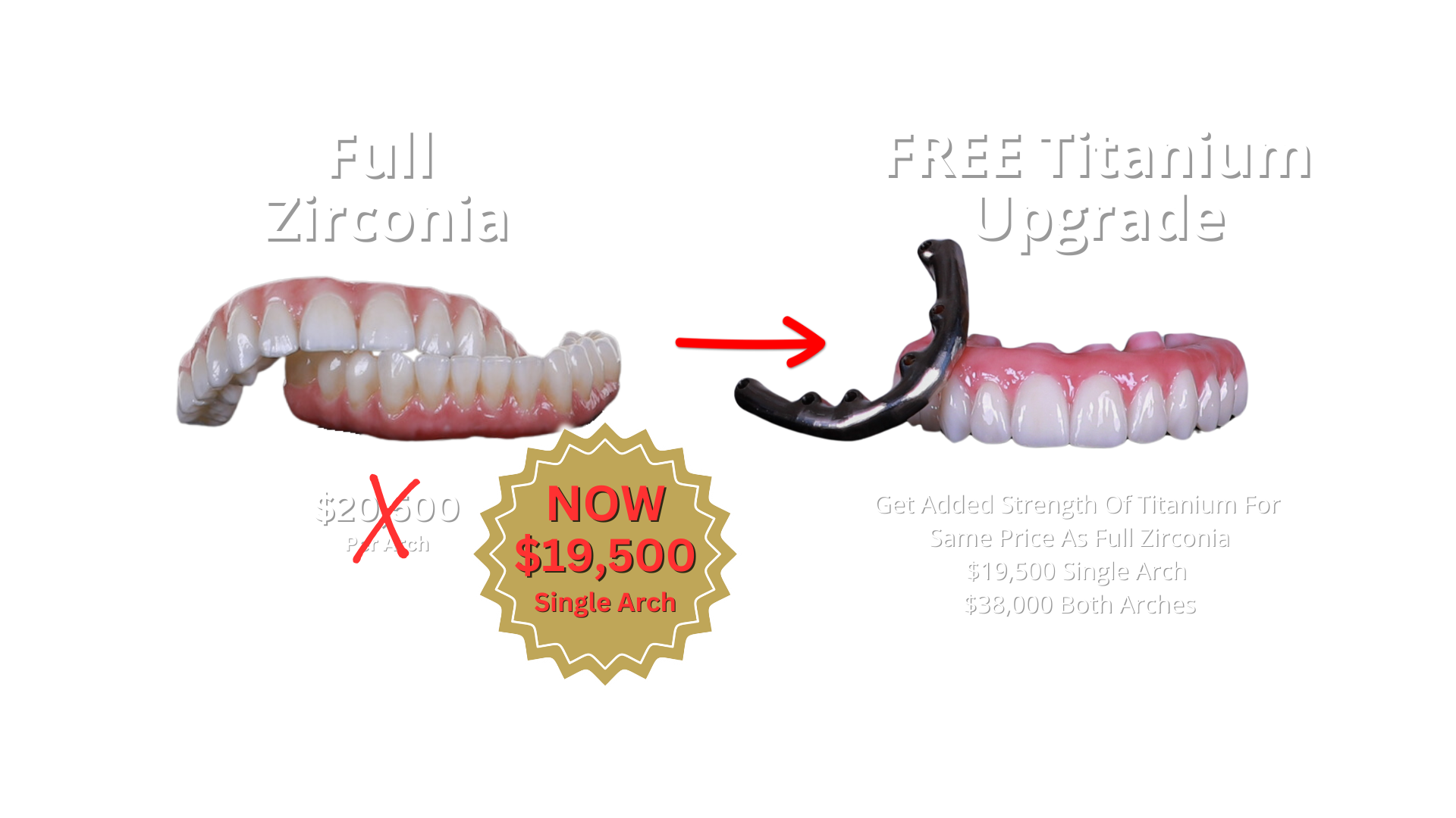 Dental implant arch comparison showing zirconia and zirconia with titanium bar.