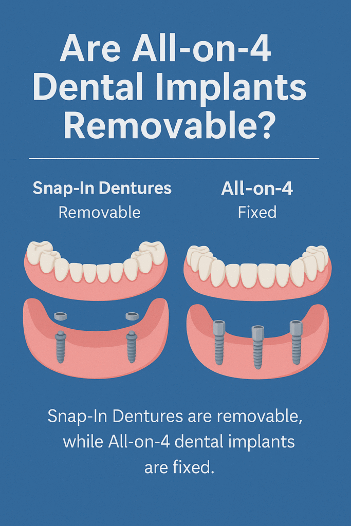 Illustration comparing removable snap-in dentures with fixed All-on-4 dental implants