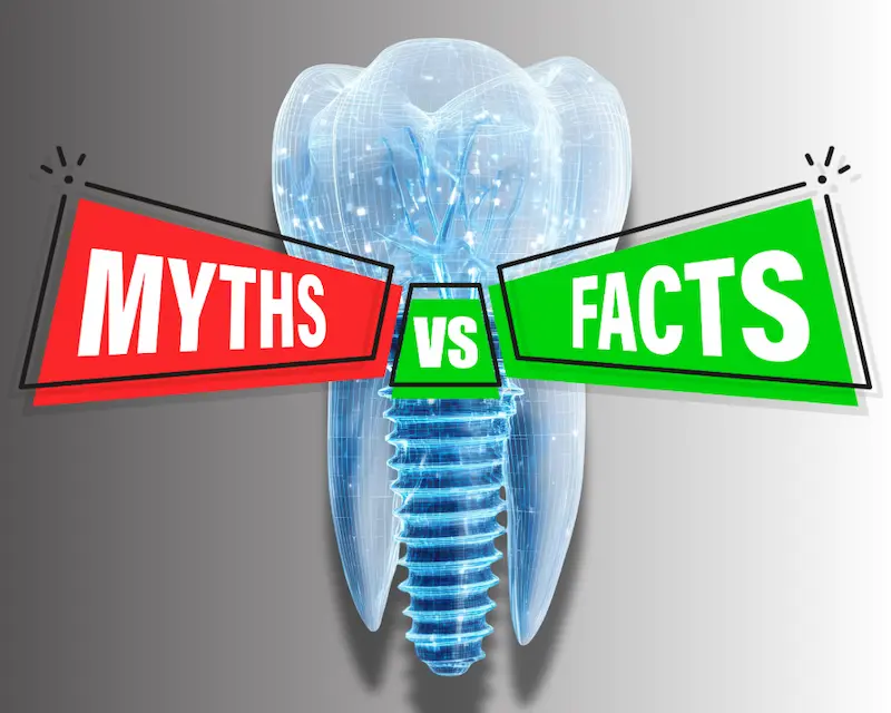 dental implant myth vs fact